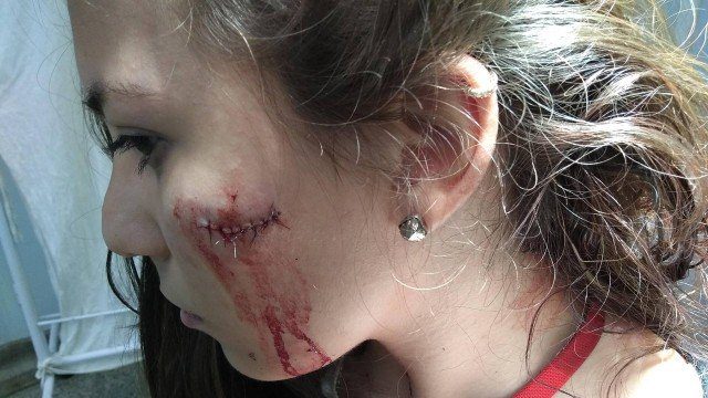 JOVEM É ESFAQUEADO EM ESTAÇÃO DE BRT NO RJ!!