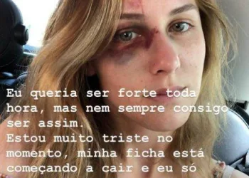 Brasileira agredida pelo namorado nos EUA faz alerta sobre relacionamento abusivo