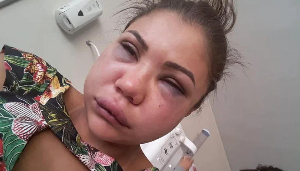 Motorista confessa ter espancado namorada por ciúmes de mensagem de amigo