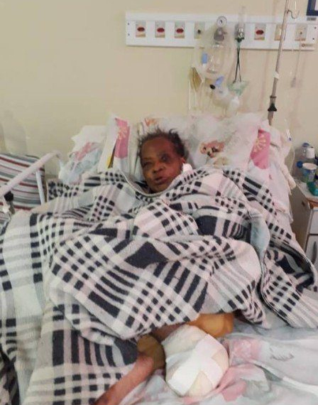 Paciente tem AVC mas acaba precisando amputar o pé por falta de cuidados em Hospital na Zona Oeste!!