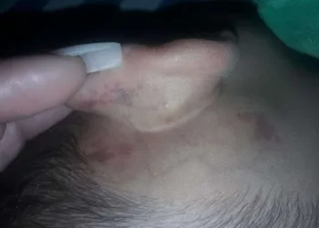 Polícia procura homem que torturava enteado na Zona Oeste