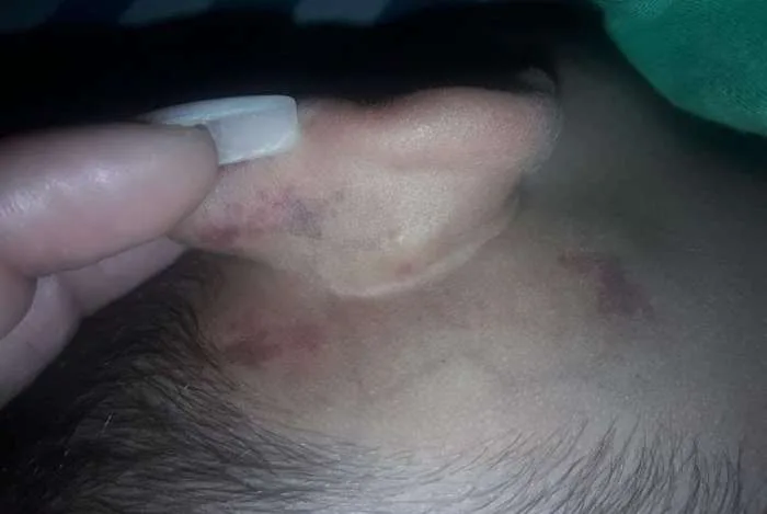 Polícia procura homem que torturava enteado na Zona Oeste