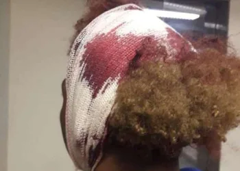 Estudante denuncia agressão por homofobia em escola no RJ!!