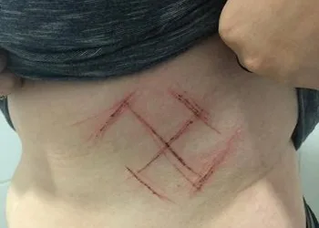 Polícia Civil do RS reabre investigação de caso de ataque com suástica