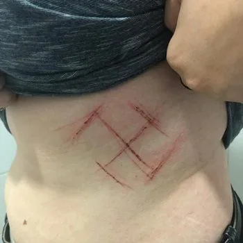 Polícia Civil do RS reabre investigação de caso de ataque com suástica