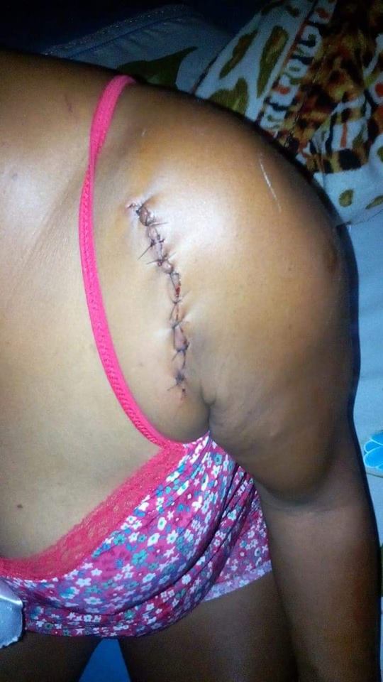 TENTATIVA DE HOMICIDIO EM GUARATIBA!