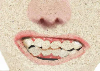 Bruxismo pode aparecer em qualquer idade e geralmente tem fundo psicológico