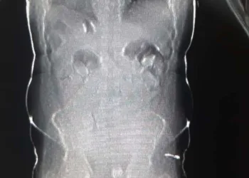 PF prende, no aeroporto, estrangeiros que engoliram 50 cápsulas de cocaína