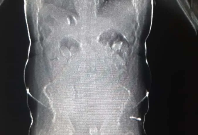PF prende, no aeroporto, estrangeiros que engoliram 50 cápsulas de cocaína