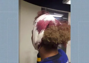 Polícia investiga agressão motivada por homofobia em escola do Rio