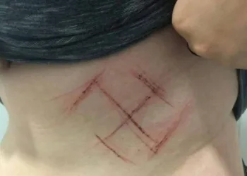 Suástica: Jovem que fez denúncia desiste de caso, polícia investiga