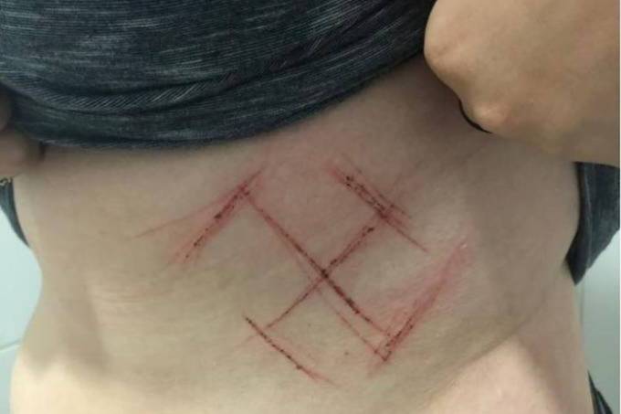 Suástica: Jovem que fez denúncia desiste de caso, polícia investiga