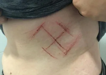 Jovem diz que foi marcada com canivete por vestir camiseta com ‘#elenão’
