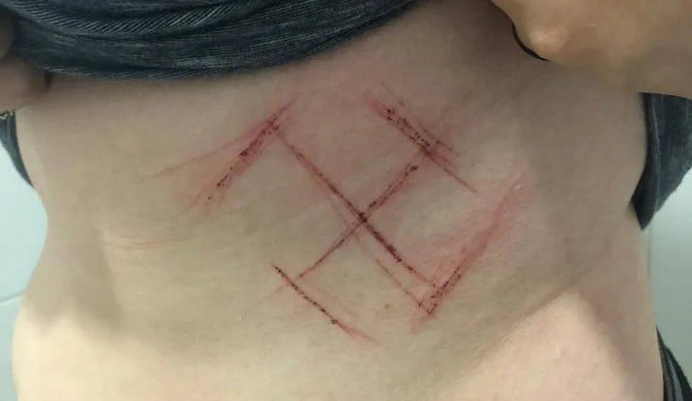 Jovem diz que foi marcada com canivete por vestir camiseta com ‘#elenão’