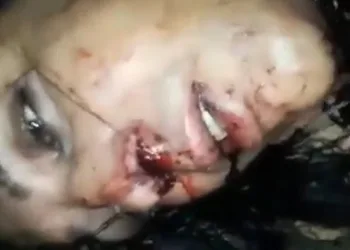 Jovem homossexual é espancado e quase morre por apoiar Jair Bolsonaro; veja vídeo