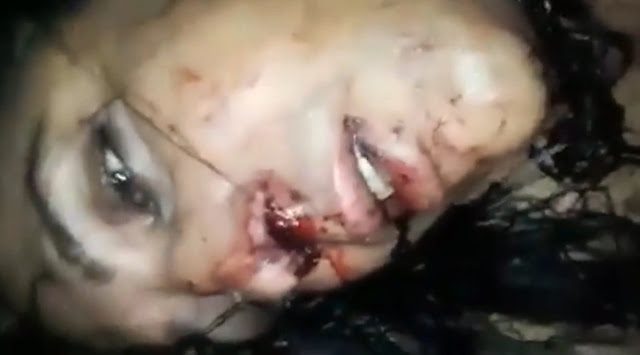 Jovem homossexual é espancado e quase morre por apoiar Jair Bolsonaro; veja vídeo