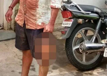 FIM DOS TEMPOS!! Homem vai a delegacia com a cabeça de vítima decapitada por ciúme da mãe