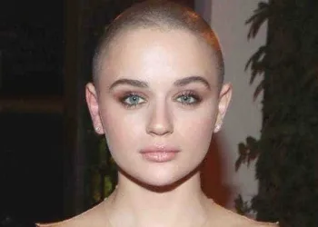 Careca, atriz  relata preconceito: ‘Droga de um câncer’