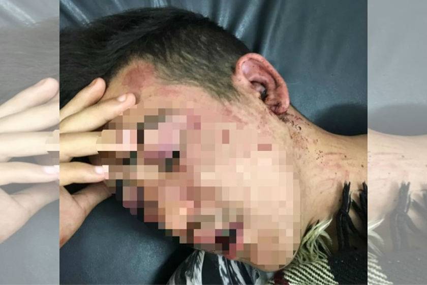 Jovens são espancados em saída de festa. Seguranças são suspeitos