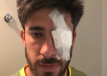 Médico do Boca Juniors mostra imagens de jogadores feridos após ataque