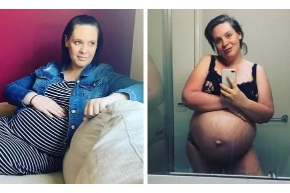 Australiana pretende transmitir seu parto ao vivo na noite de Natal