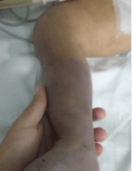 Bebê pode perder a perna por negligência médica no RJ!!