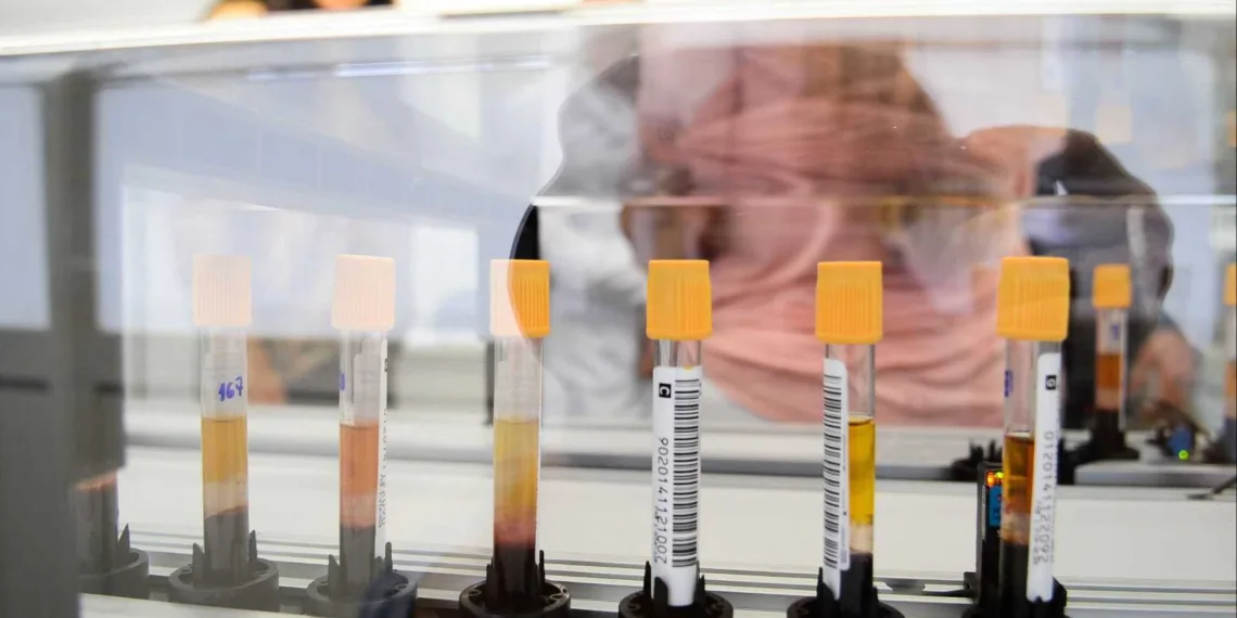 Febre amarela matou 84 pessoas no estado do Rio este ano