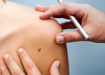 Mortes por câncer de pele aumentam no Brasil, aponta pesquisa