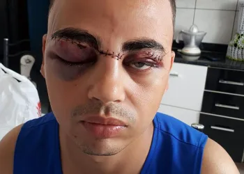 LINHA COM CEROL FAZ MAIS UMA VITIMA