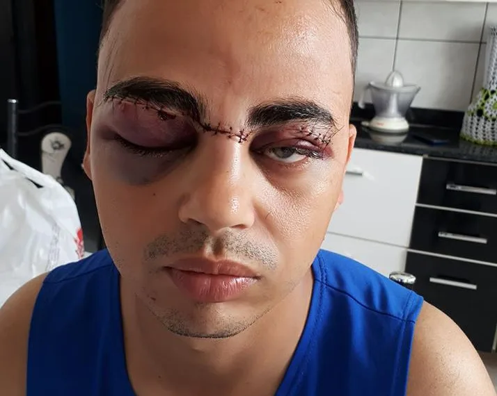 LINHA COM CEROL FAZ MAIS UMA VITIMA