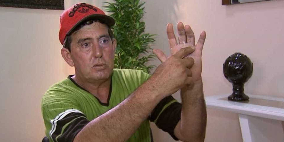 Homem acorda da anestesia e descobre que médico operou dedo errado