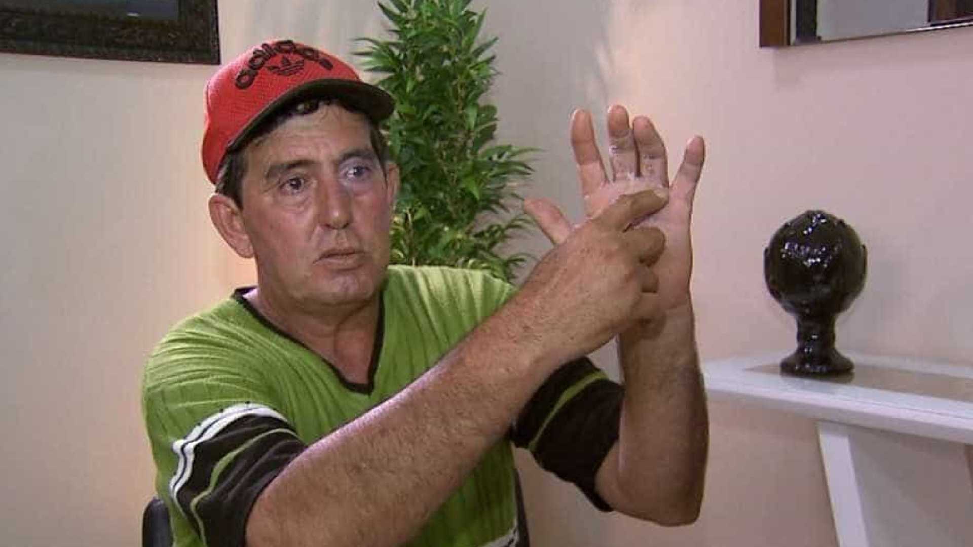 Homem acorda da anestesia e descobre que médico operou dedo errado