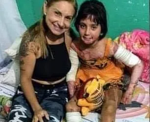 URGENTE!!! MENINA TEVE QUEIMADURAS E PRECISA DA SUA AJUDA!! VAMOS AJUDAR!!