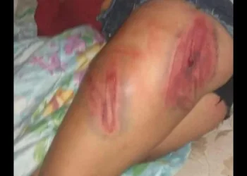 MULHER MORRE CARBONIZADA E TRÊS FICARAM FERIDAS POR TRAFICANTES NO RJ!! FAMILIAS PEDEM SOCORRO!!