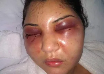 FILHO DE VEREADOR AGRIDE BRUTALMENTE A ESPOSA EM CAMPO GRANDE!!(FOTOS)