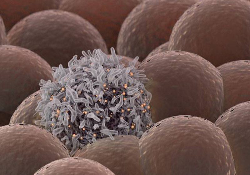 Israel cria droga para curar câncer de cérebro