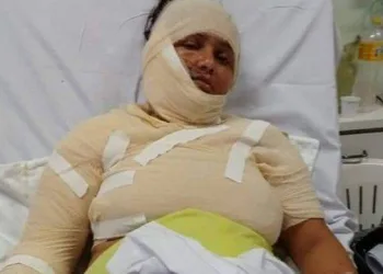 Homem deixa mulher com 70% do corpo queimado por não aceitar separação