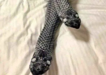 Mulher usa meia-calça de “cobra”, assusta o marido e vai parar no hospital