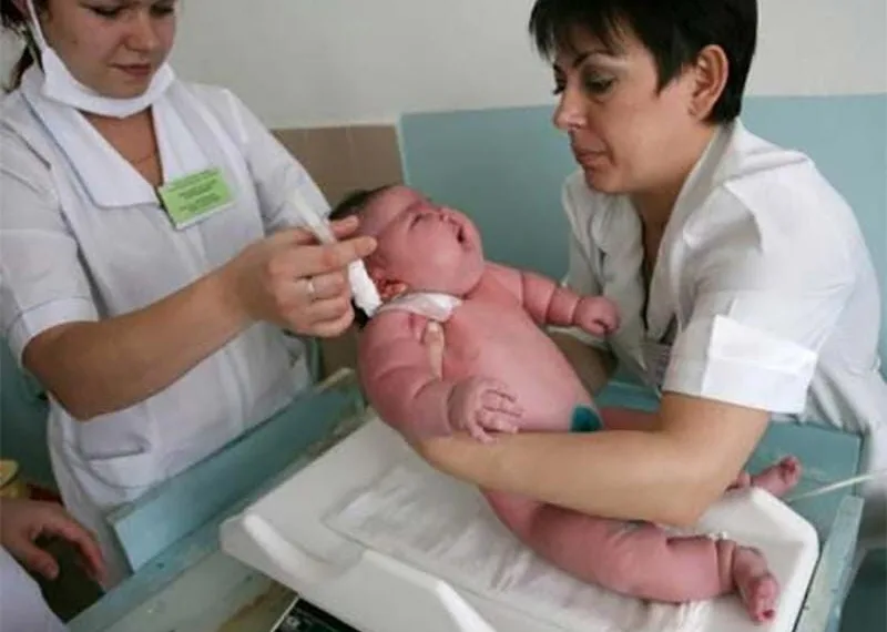 BEBÊ NASCE COM 18 KG E BATE O RECORDE DE MAIOR BEBÊ DO MUNDO