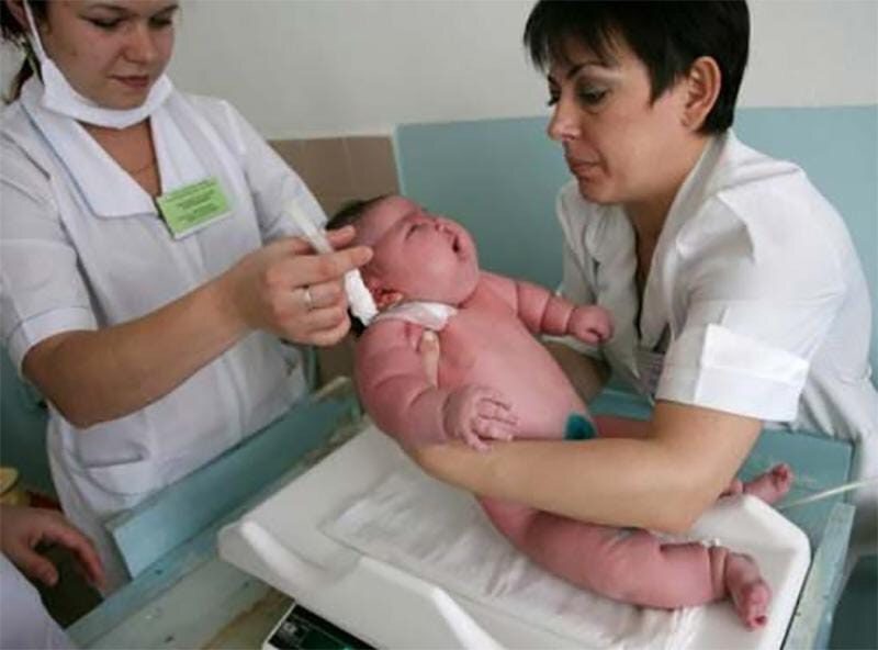 BEBÊ NASCE COM 18 KG E BATE O RECORDE DE MAIOR BEBÊ DO MUNDO