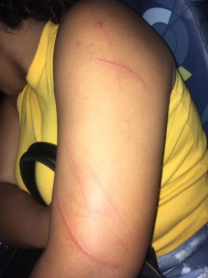 ASSALTO EM CAMPO GRANDE!!! VITIMA EM DESESPERO!!