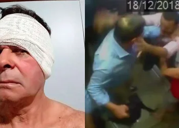 Idoso agredido faz revelação sobre repórter da Globo: “disse que estava possuído por três demônios”