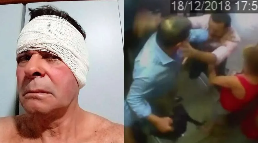 Idoso agredido faz revelação sobre repórter da Globo: “disse que estava possuído por três demônios”