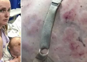Mãe vira escudo humano para proteger bebê de tempestade de granizo