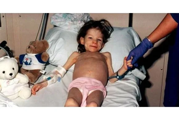 Polícia divulga foto atual de criança que ficou presa no armário por 6 anos e mudança choca