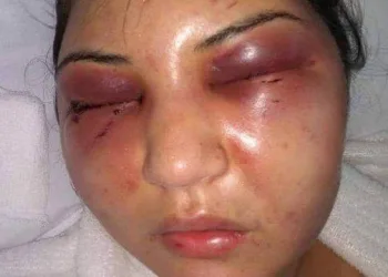 Justiça nega prisão de Fábio Felippe, suspeito de agredir mulher em Campo Grande