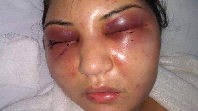 Justiça nega prisão de Fábio Felippe, suspeito de agredir mulher em Campo Grande