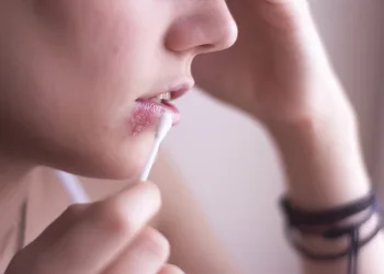 Herpes: conheça os tipos mais comuns do vírus e saiba como preveni-los