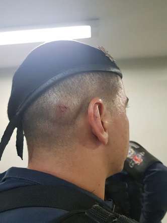 Policial militar foi agredido com um cabo de vassoura de ferro(foto: Reproduçăo/PMDF)