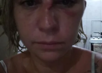 Ana Cristina Pimentel:Vítima de tentativa de feminicidio.